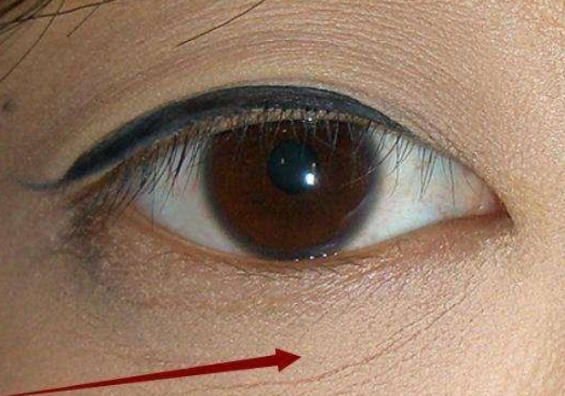 65岁赵雅芝调晒照不服老！手捧鲜花低似35岁，眼角卡粉有些尴尬