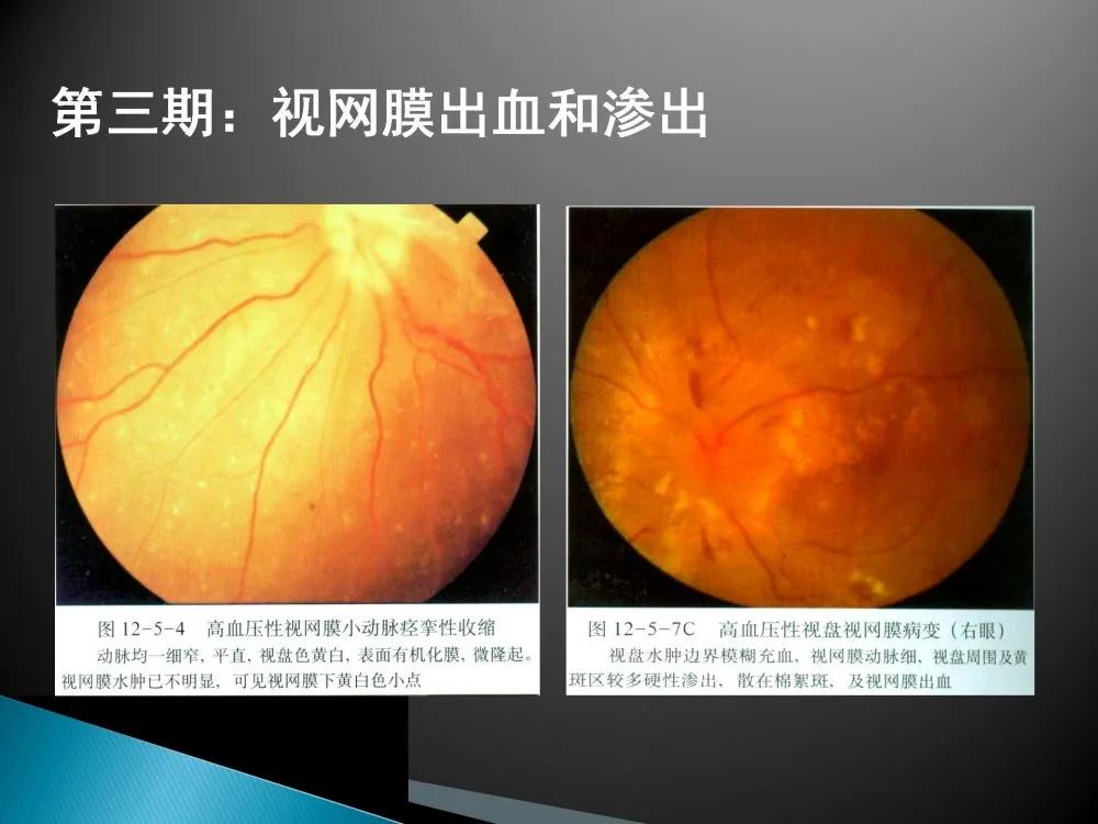 健康科普大赛获奖作品展示⑤|老年人常见眼部不适