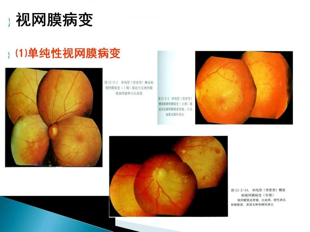 健康科普大赛获奖作品展示⑤|老年人常见眼部不适