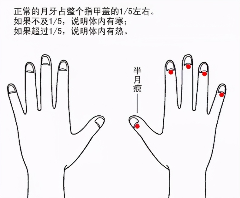 月牙是什么？为啥有的指甲没有月牙？这样代表不健康吗