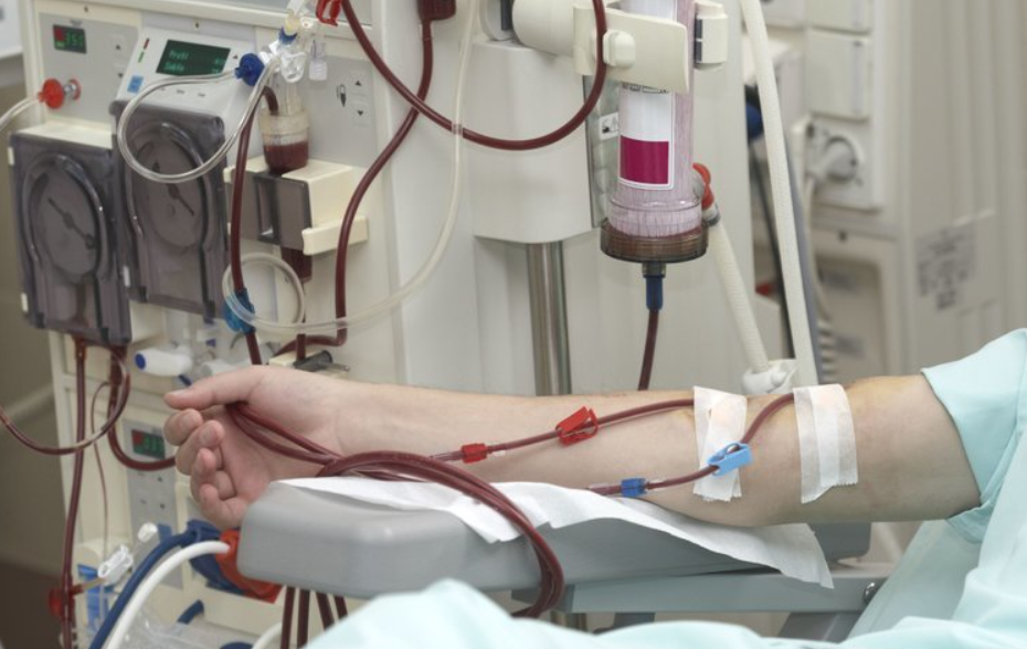 尿毒症多是�吃�出來的？ 這4種食物少碰，腎會感激你