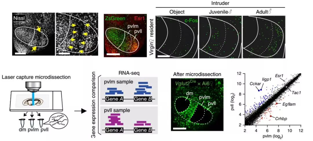 医学科普微小脑区的精确再细分