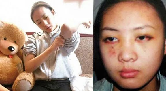 被前男友暴打、星途黯淡多年，“美强惨”女星