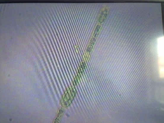 藻就是一种螺旋状的鱼腥藻,图中也能看到较大的异形胞这个是蓝纤维藻