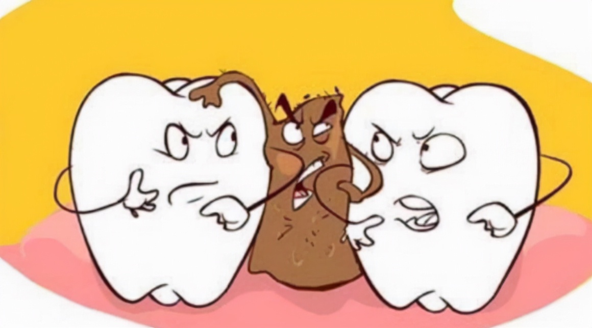 牙齿内侧等隐蔽角落还残留着食物残渣,长时间堆积容易诱发牙结石,蛀牙