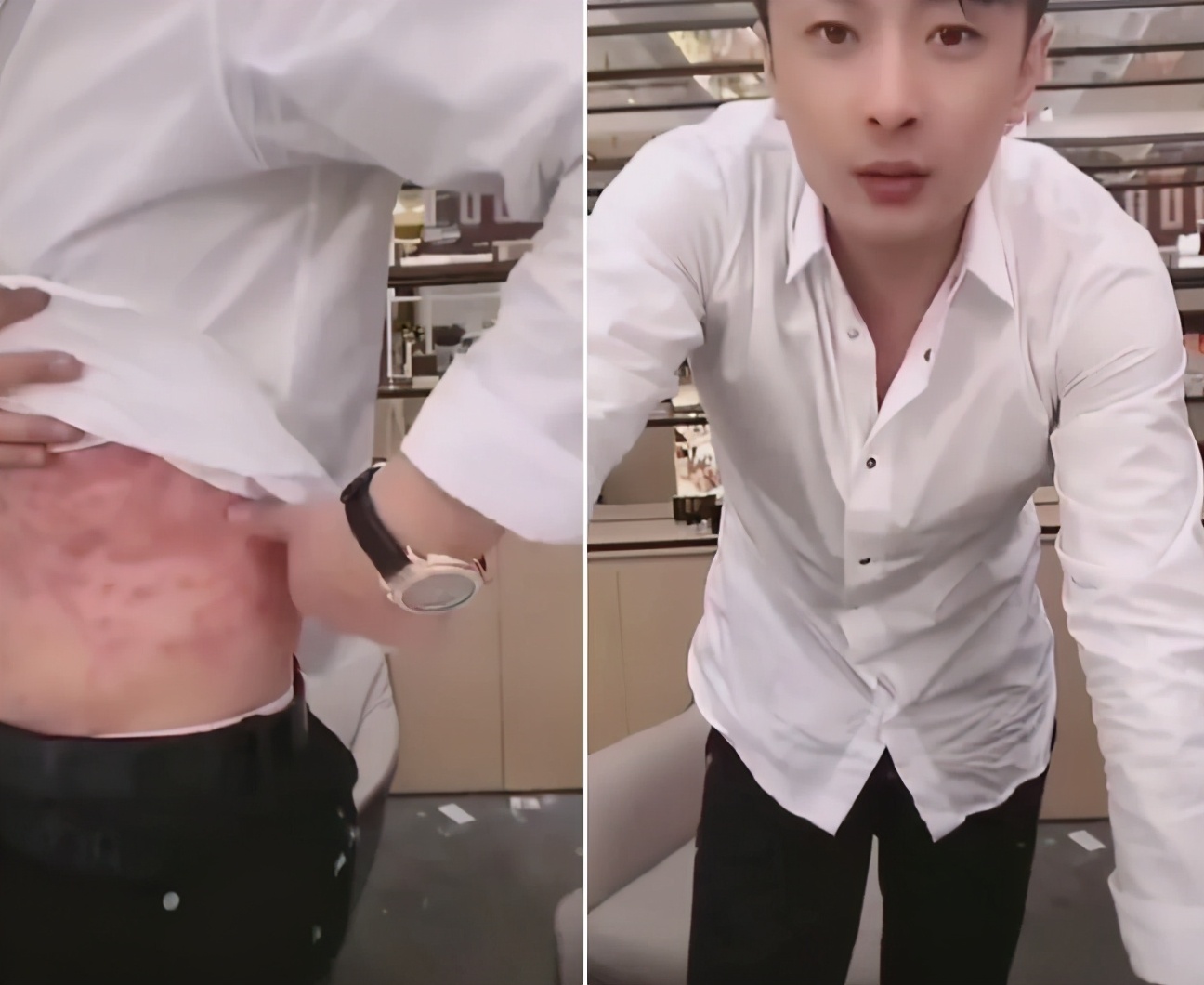 辛巴到底什么原因?病情恶化还是与李佳琪薇娅事件