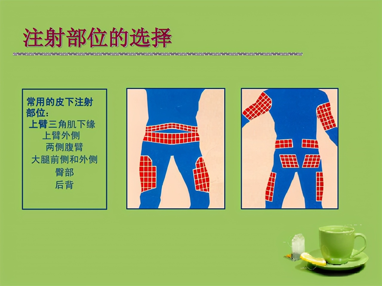 新型降糖药度拉糖肽，减重降压降脂，降尿酸降尿蛋白，保护心血管