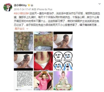 “千万别化疗，一化疗人就没了”？化疗究竟会