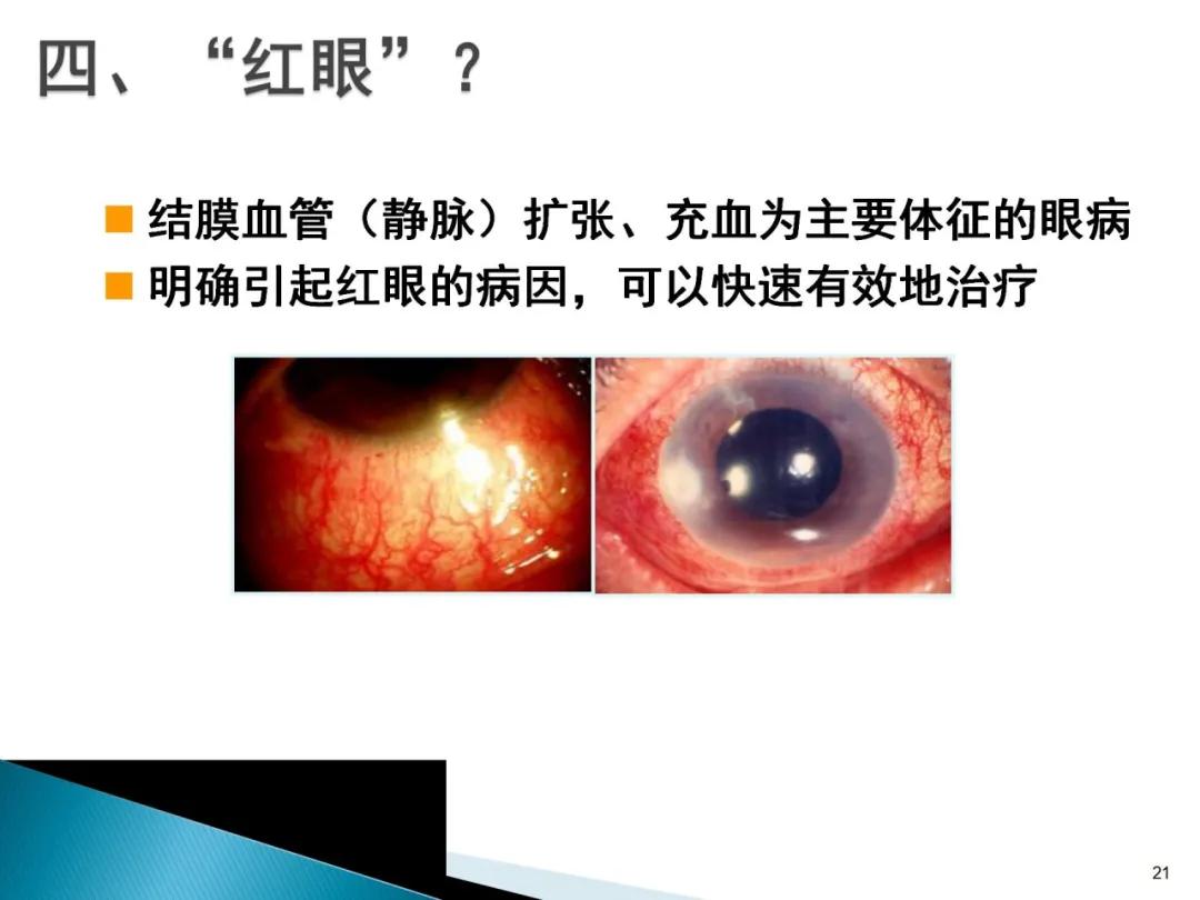 健康科普大赛获奖作品展示⑤|老年人常见眼部不适