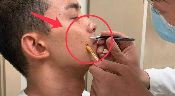 太心疼！吴磊拍戏炸伤脸，脸上全是伤口，他却坚持拍完才就医
