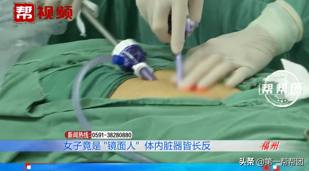 女子腹痛入院，醫(yī)生檢查后大吃一驚，器官竟全都長(zhǎng)反了？