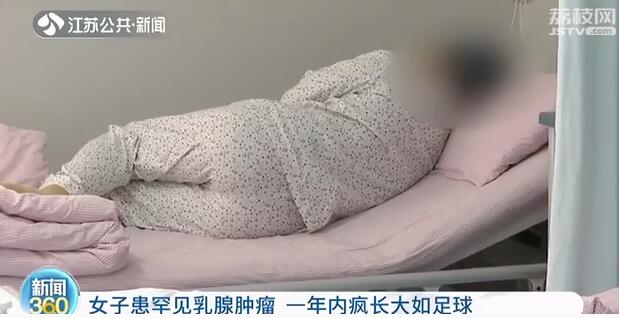 女子患罕见乳腺肿瘤 一年内疯长大如足球