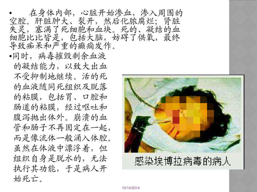 X病毒来袭，活烫穿山甲、煮猴子，非洲的报复即将开始