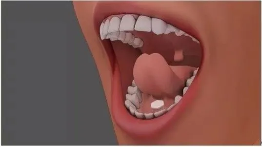 舌下的急救药：硝酸甘油