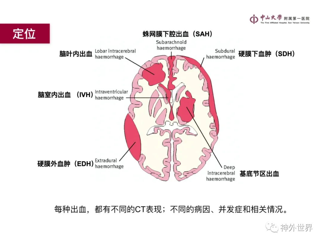 最全影像总结 | 颅内病变 MR、CT 的阅片技巧，太赞了