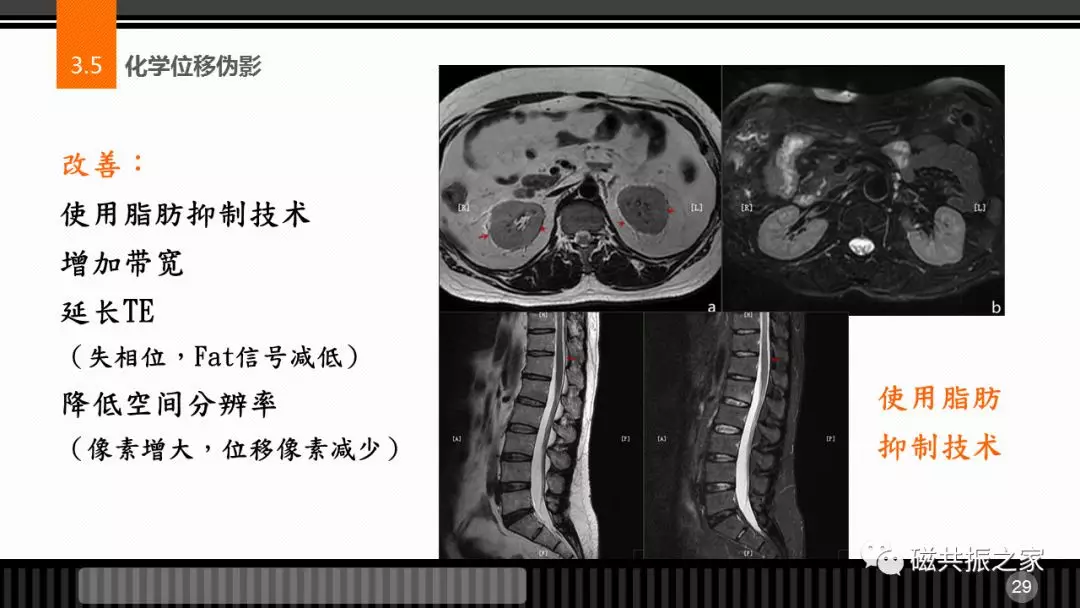 磁共振常见伪影及策略