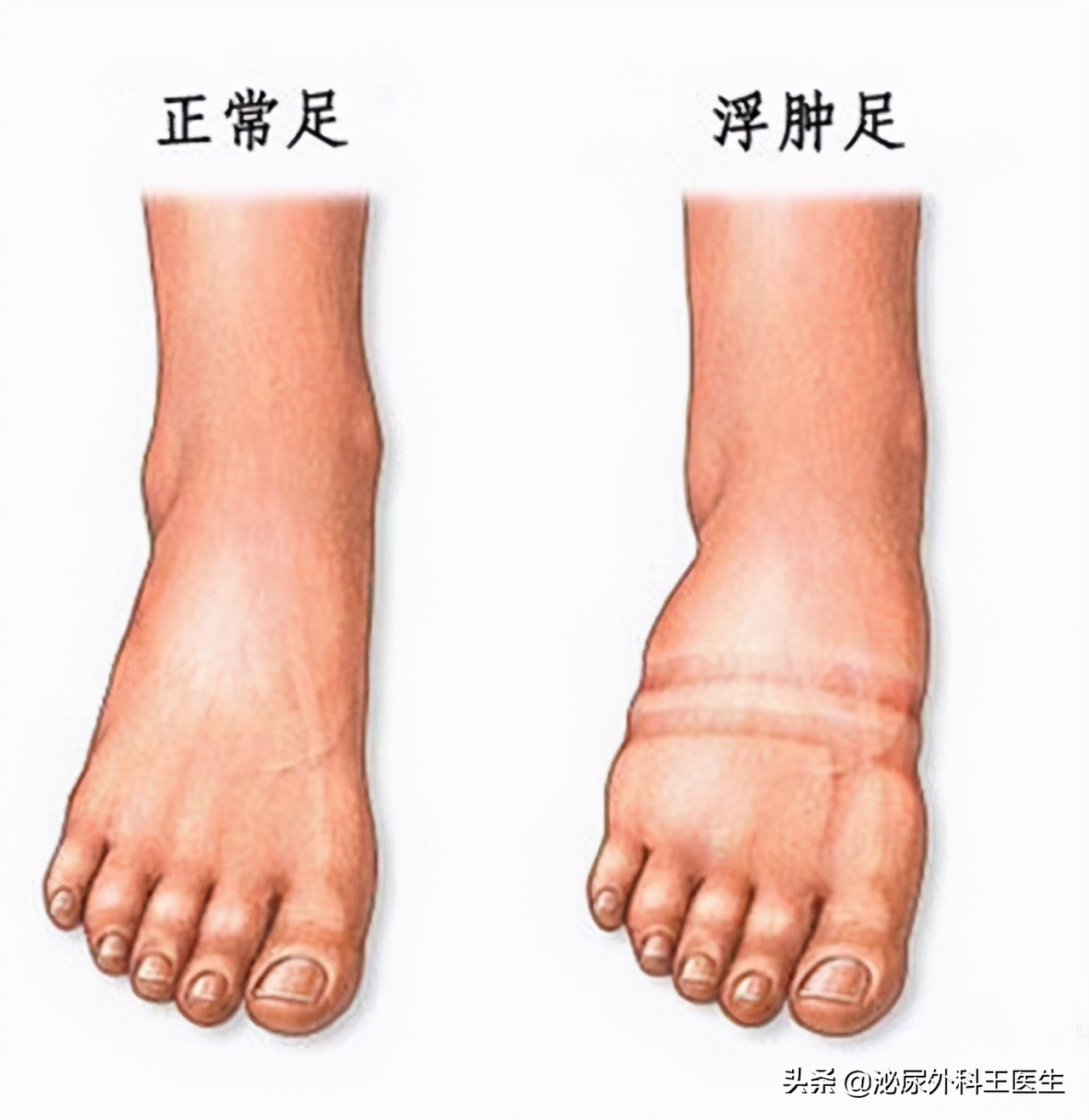 甘草片价格便宜，效果明显，深受百姓欢迎，为何会成为&ldquo;禁药&rdquo;？