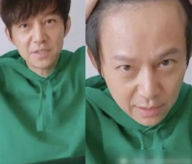 有种反差叫掀开刘海，杨幂发际线后移，看到l