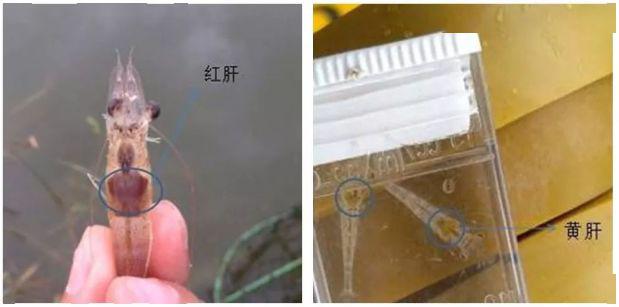 虾肝脏不好出现白便的原因 虾肝脏引起的白便如何治疗