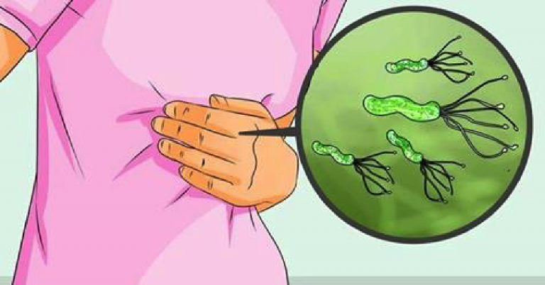 感染幽门螺杆菌一定要治疗吗？