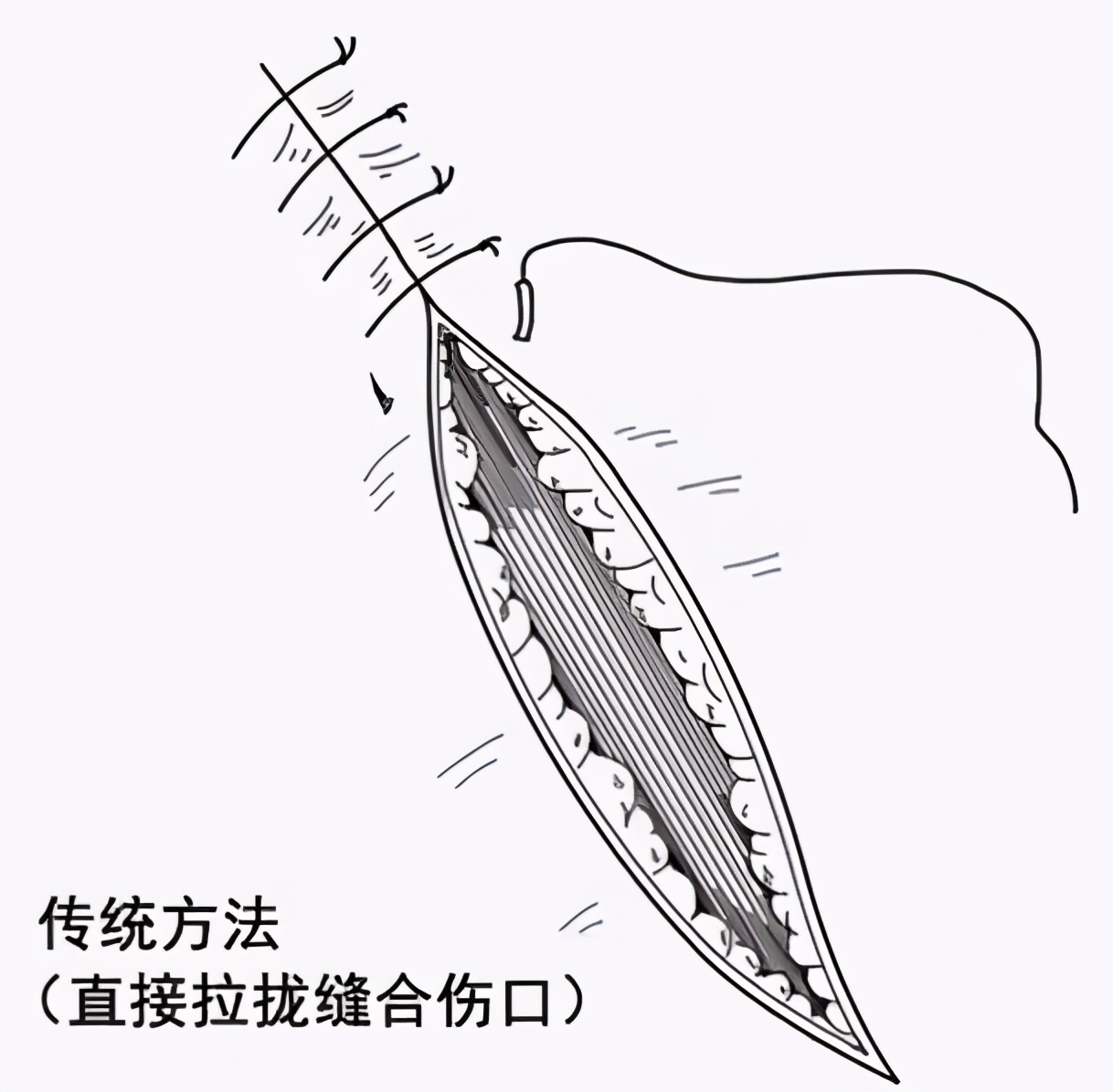 小线头，大烦恼