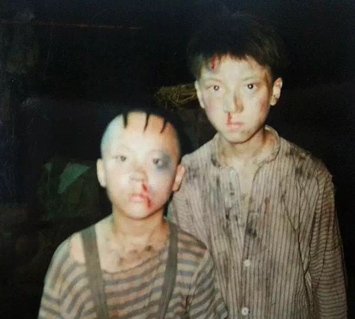 “三毛”长大了！8岁成名，14岁秃顶，34岁变帅哥