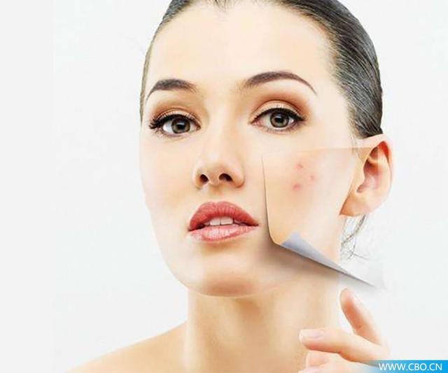 祛斑祛痘产品怎么做推广？