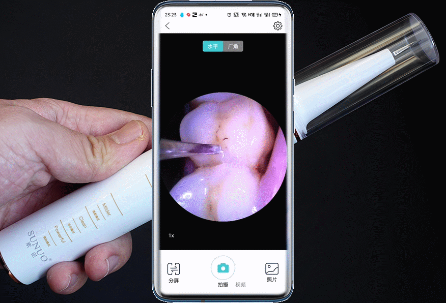智能可视超声波洁牙仪T11pro：在家就可以给牙齿做SPA