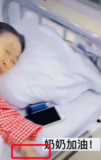 75岁张少华病逝，住院照曝光，双鼻插管手腕有淤青瘦成皮包骨
