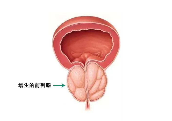 深藏不露却关乎「性福」，男性身上的前列腺有多神奇？
