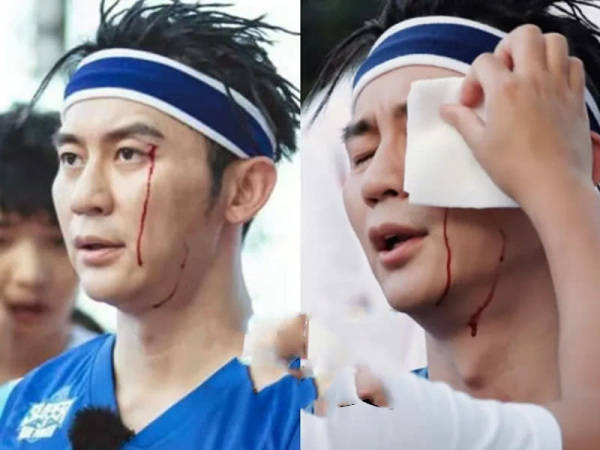 明星参加综艺有多危险？杨颖骨折，  李晨医院