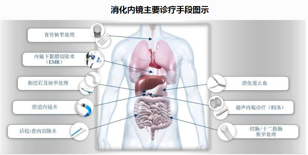 安杰思IPO:境外产品召回或伤元气，曾陷专利诉讼品控也存疑