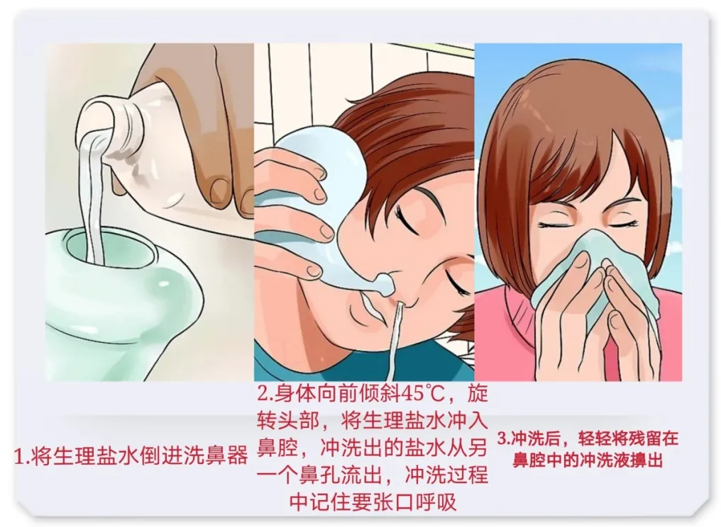 鼻炎 or 鼻窦炎？一鼻之差，症状大不同