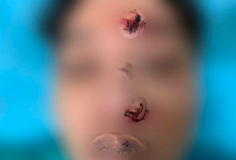 南京20岁大学生宿舍内身亡，面部伤口引家属怀疑，警方展开调查