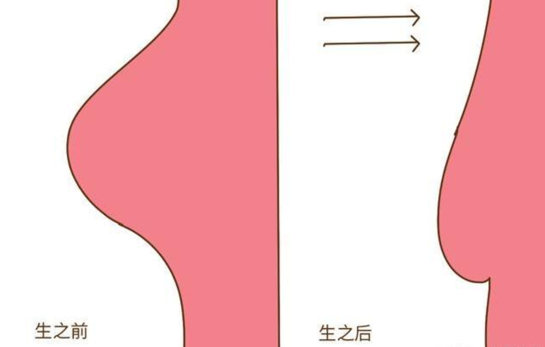 生过孩子的女人，和没生过的有哪些变化？过来人直言：从里到外