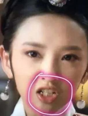 明星整牙前后的对比，堪比整容，看完你就知道牙齿有多么重要