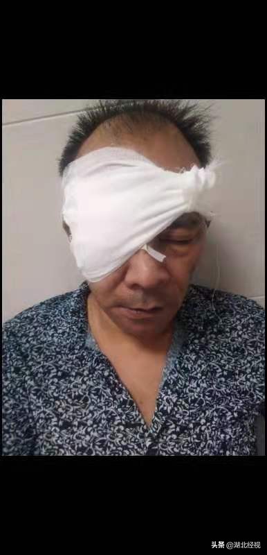 小区多名业主遭物业公司殴打警方介入调查