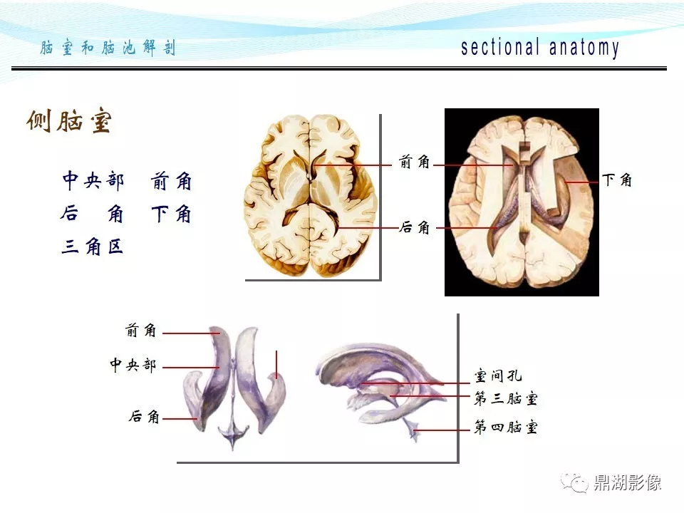 超全详解：脑池和脑室断层解剖