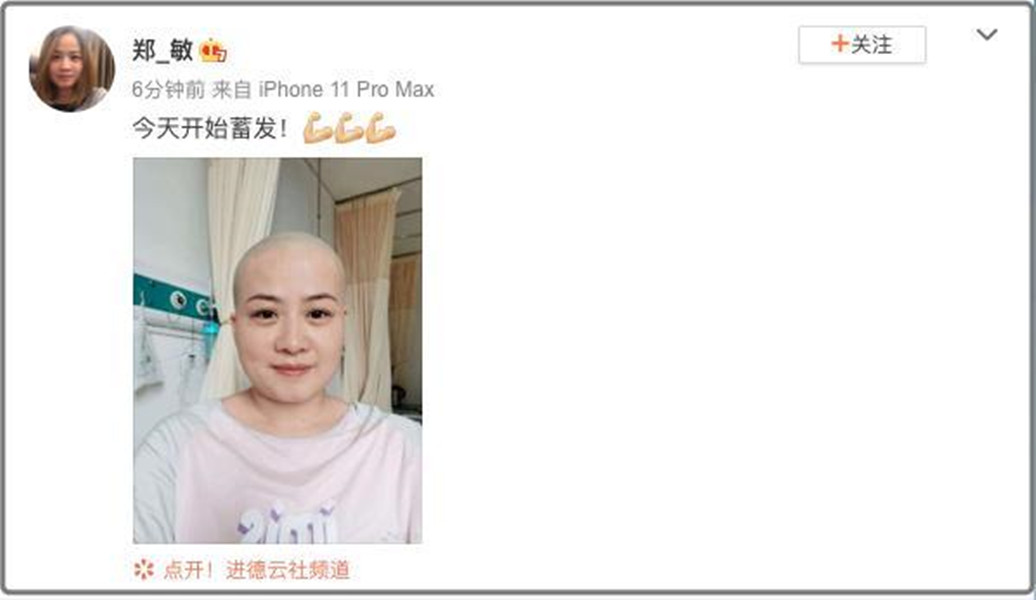 岳云鹏老婆自曝需手术，"秃头"造型令人