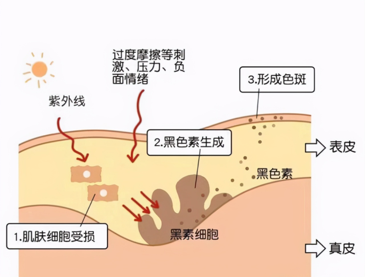 面膜多久敷一次才好？难怪护肤品不吸收，皮肤还是干燥起皮