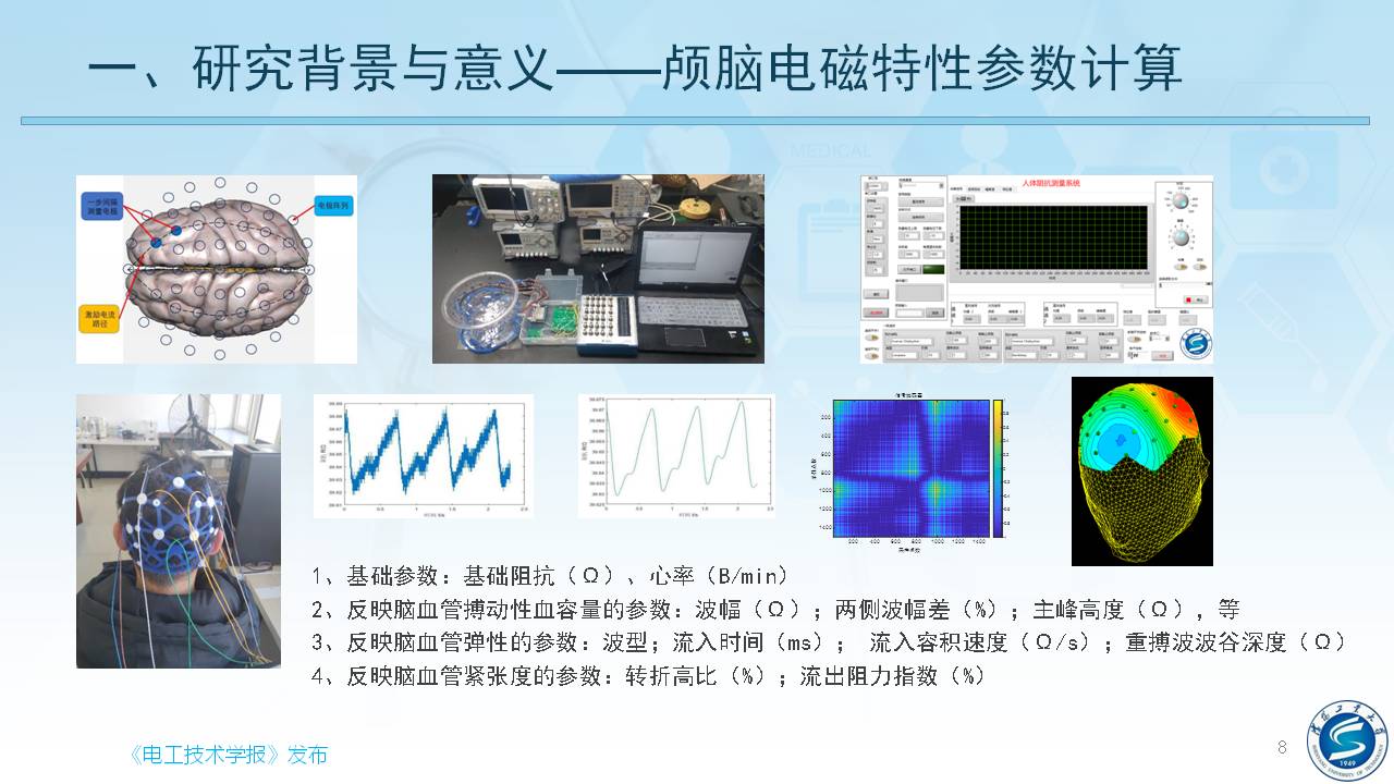 沈陽工業(yè)大學(xué)柯麗教授：感應(yīng)式顱腦電磁特性檢測與成像方法研究