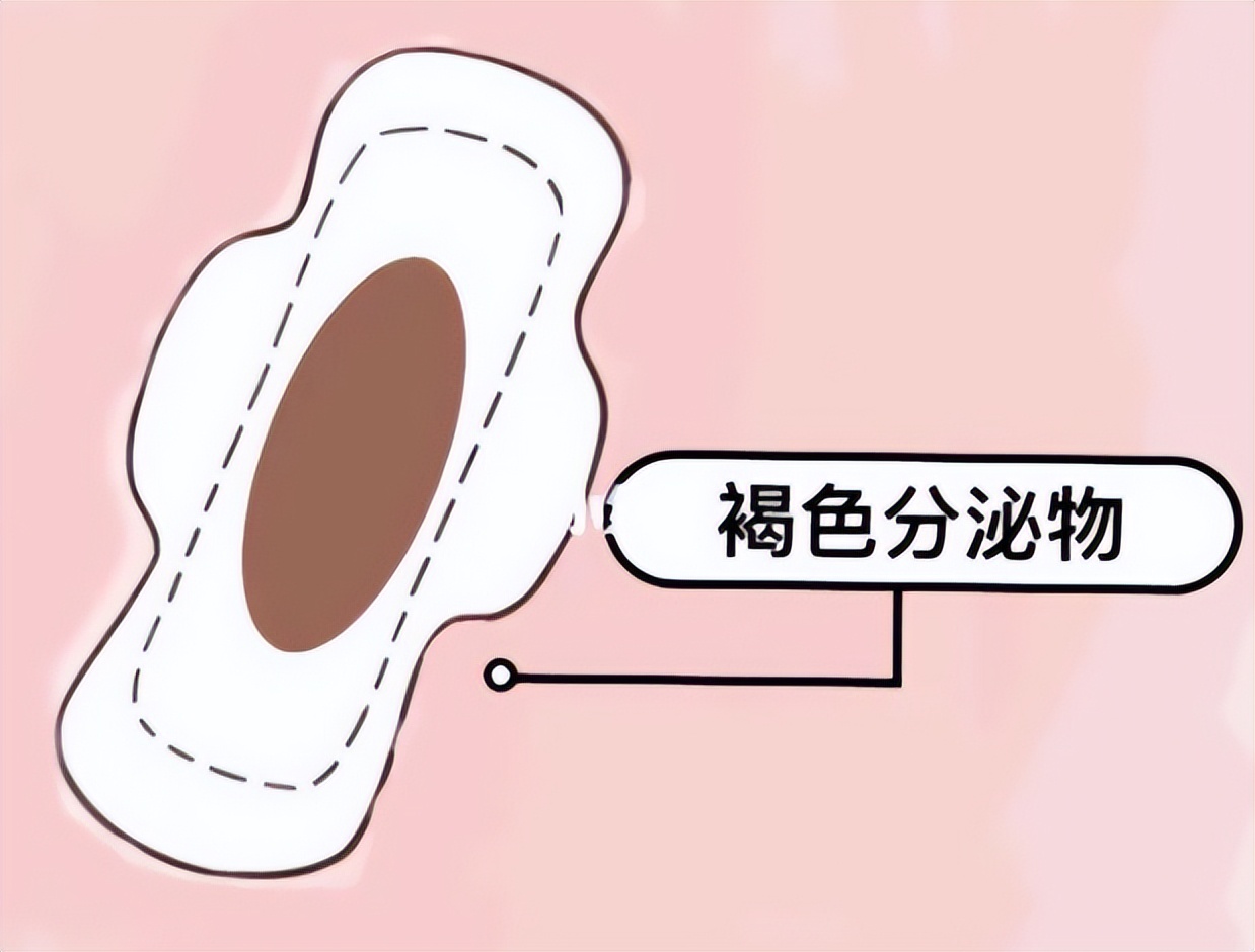 Why is there a "brown discharge" after menstruation?If you have it, pay