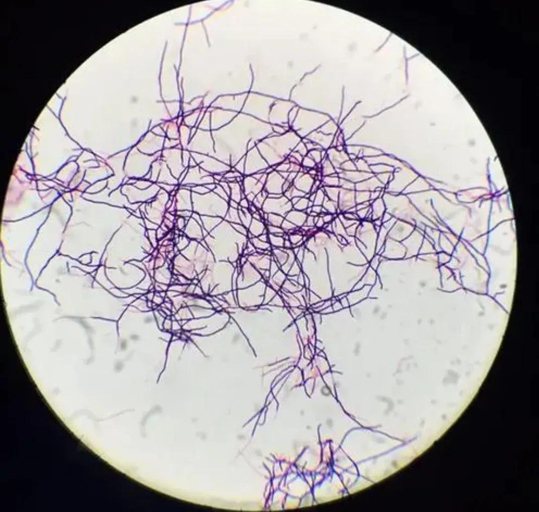 Do you know these amazing microbes? - iNEWS